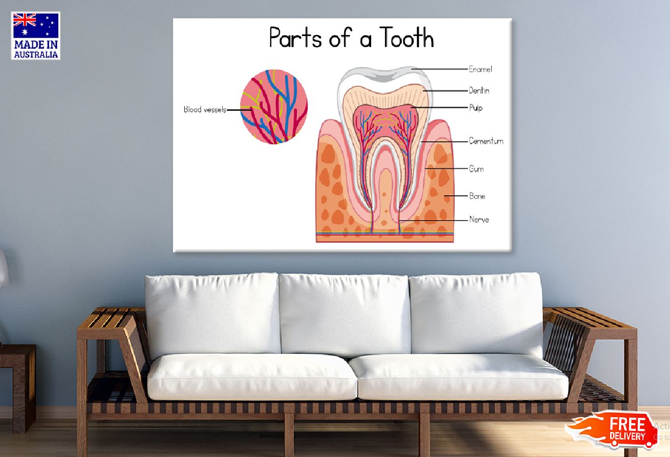 Parts of a Tooth Vector Illustration Print 100% Australian Made Stretched Canvas Ready to Hang - 2417