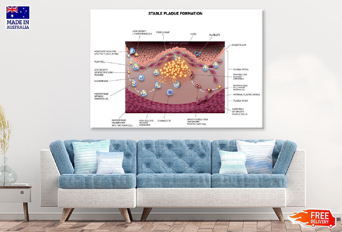 Stable Plaque Formation Vector Print 100% Australian Made Stretched Canvas Ready to Hang - 2401