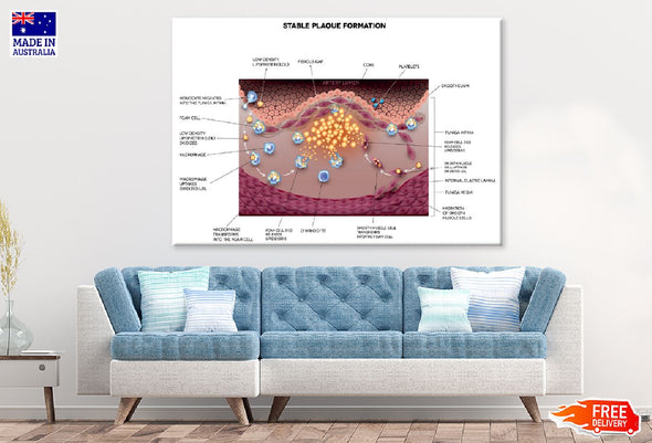 Stable Plaque Formation Vector Print 100% Australian Made Stretched Canvas Ready to Hang - 2401