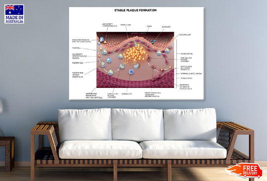 Stable Plaque Formation Vector Print 100% Australian Made Stretched Canvas Ready to Hang - 2401