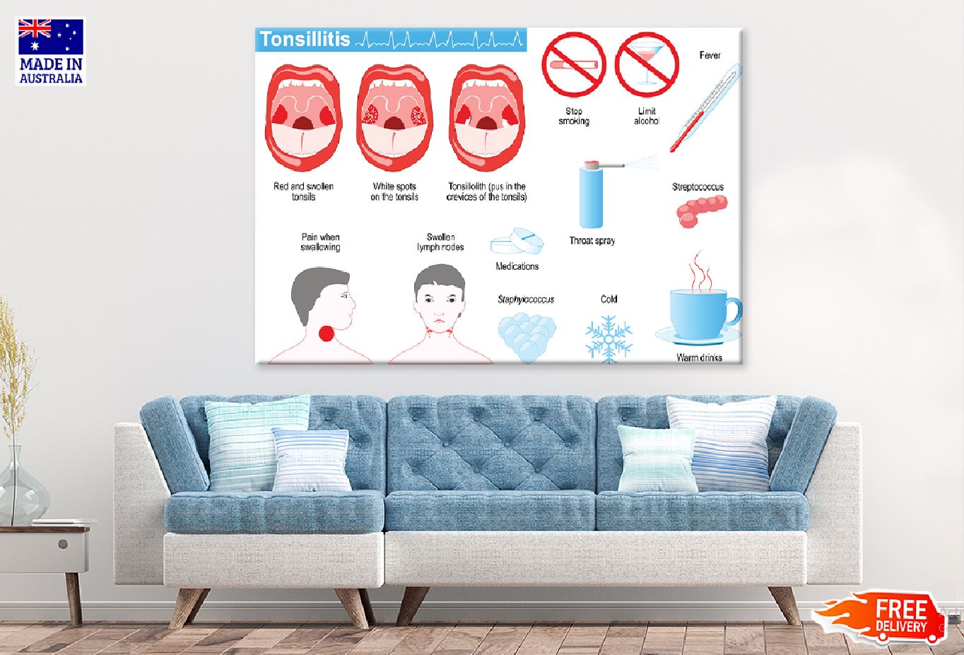 Tonsillitis Vector Illustration Print 100% Australian Made Stretched Canvas Ready to Hang - 2402