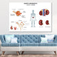 Diabetic Nephropathy Vector Design Print 100% Australian Made Stretched Canvas Ready to Hang - 2403