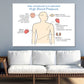 Human High Blood Pressure Anatomy Print 100% Australian Made Stretched Canvas Ready to Hang - 2406