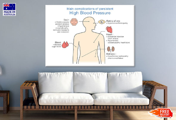 Human High Blood Pressure Anatomy Print 100% Australian Made Stretched Canvas Ready to Hang - 2406