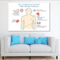 Human High Blood Pressure Anatomy Print 100% Australian Made Stretched Canvas Ready to Hang - 2406