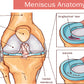 Meniscus Anatomy Vector Illustration Print 100% Australian Made Stretched Canvas Ready to Hang - 2407