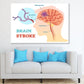 Brain Stroke Vector Anatomy Print 100% Australian Made Stretched Canvas Ready to Hang - 2413