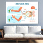 Reflex ARC Vector Illustration Print 100% Australian Made Stretched Canvas Ready to Hang - 2415