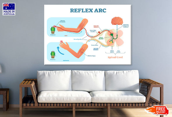 Reflex ARC Vector Illustration Print 100% Australian Made Stretched Canvas Ready to Hang - 2415