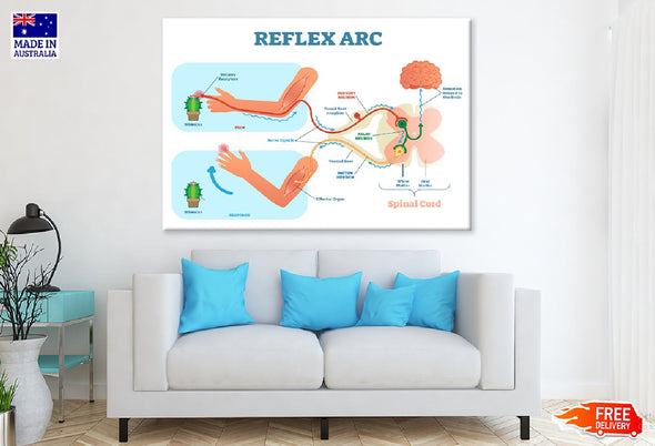 Reflex ARC Vector Illustration Print 100% Australian Made Stretched Canvas Ready to Hang - 2415