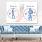 Human Normal & Varicose Vein Vector Print 100% Australian Made Stretched Canvas Ready to Hang - 2416