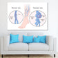 Human Normal & Varicose Vein Vector Print 100% Australian Made Stretched Canvas Ready to Hang - 2416