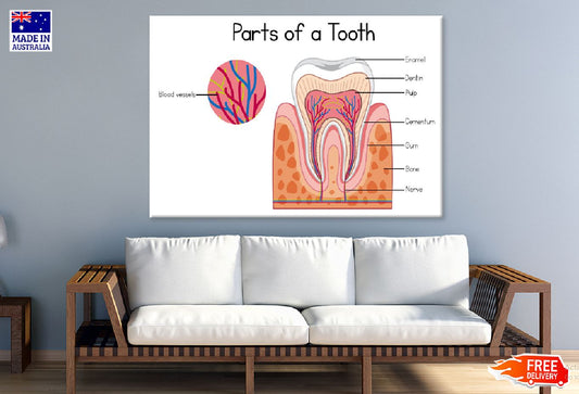 Parts of a Tooth Vector Illustration Print 100% Australian Made Stretched Canvas Ready to Hang - 2417