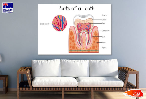 Parts of a Tooth Vector Illustration Print 100% Australian Made Stretched Canvas Ready to Hang - 2417