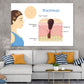 Human Blackhead Anatomy Vector Print 100% Australian Made Stretched Canvas Ready to Hang - 2423