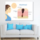 Human Blackhead Anatomy Vector Print 100% Australian Made Stretched Canvas Ready to Hang - 2423
