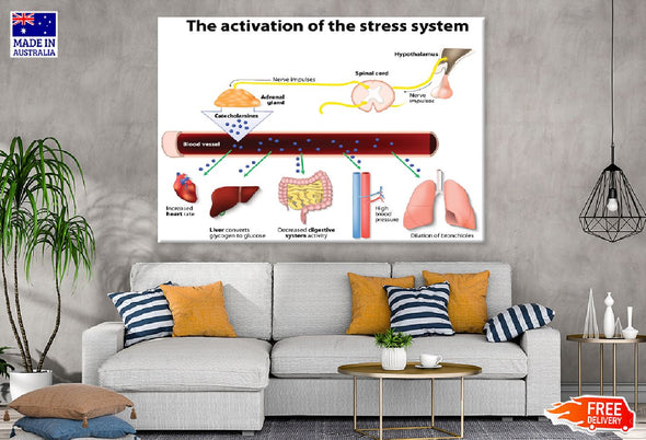 Activation of Stress System Vector Print 100% Australian Made Stretched Canvas Ready to Hang - 2388