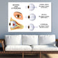 Human Myopia & Hyperopia Eye Anatomy Print 100% Australian Made Stretched Canvas Ready to Hang - 2426