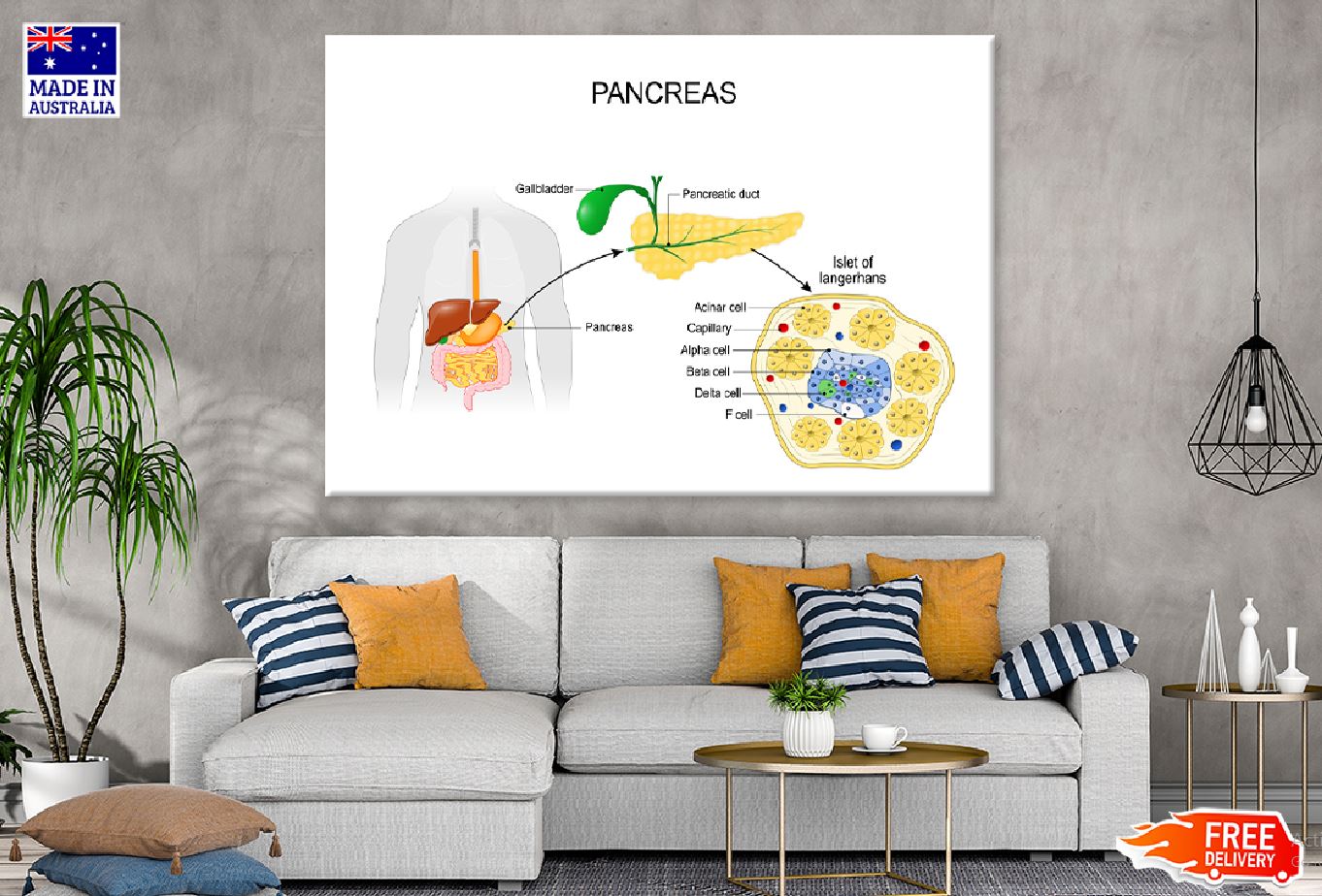 Pancreas Anatomy Vector Illustration Print 100% Australian Made Stretched Canvas Ready to Hang - 2427