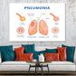 Pneumonia & Healthy Lung Anatomy Print 100% Australian Made Stretched Canvas Ready to Hang - 2435