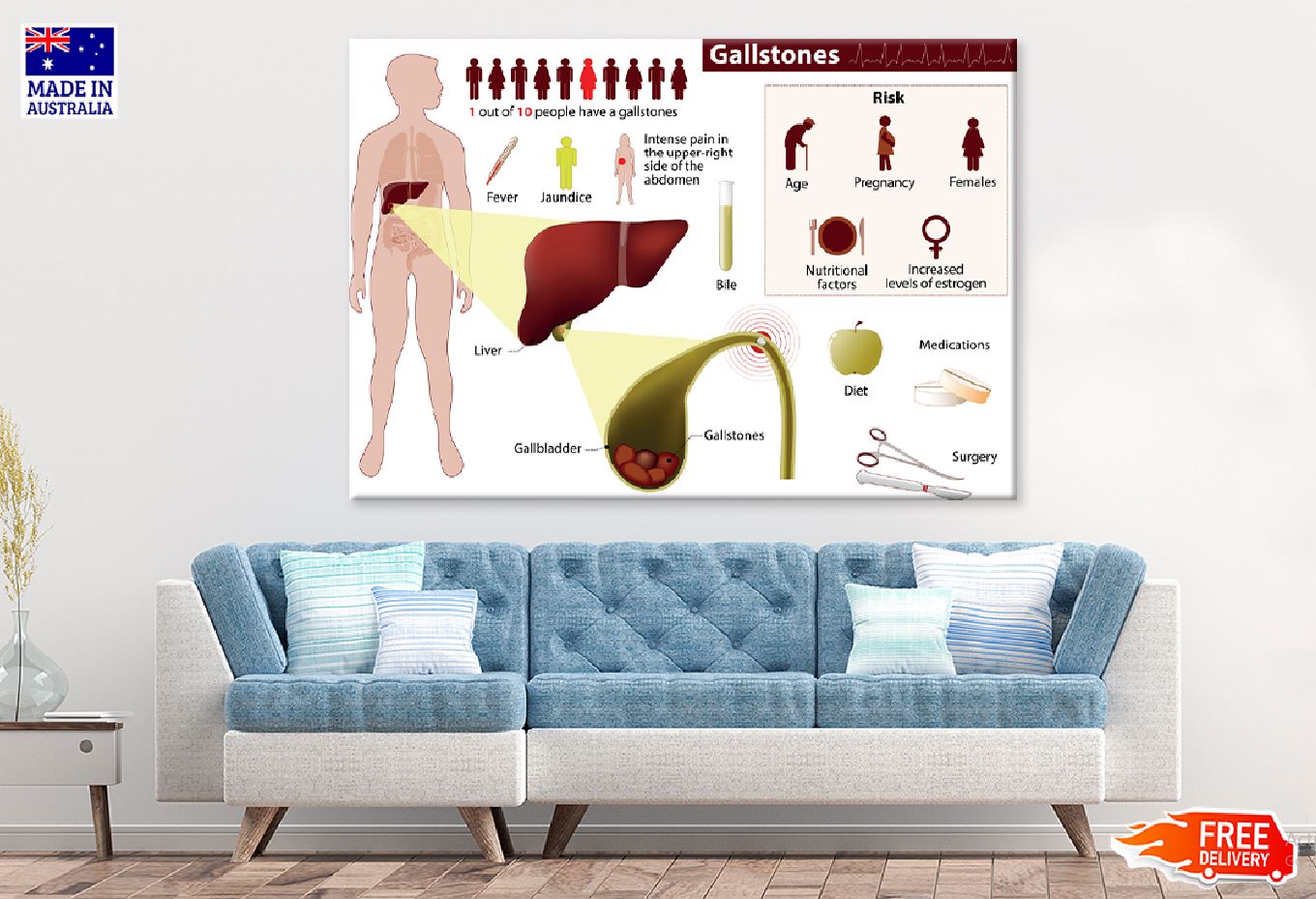 Human Gallstones Vector Illustration Print 100% Australian Made Stretched Canvas Ready to Hang - 2391