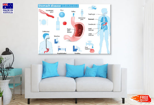 Stomach Disease Vector Illustration Print 100% Australian Made Stretched Canvas Ready to Hang - 2392