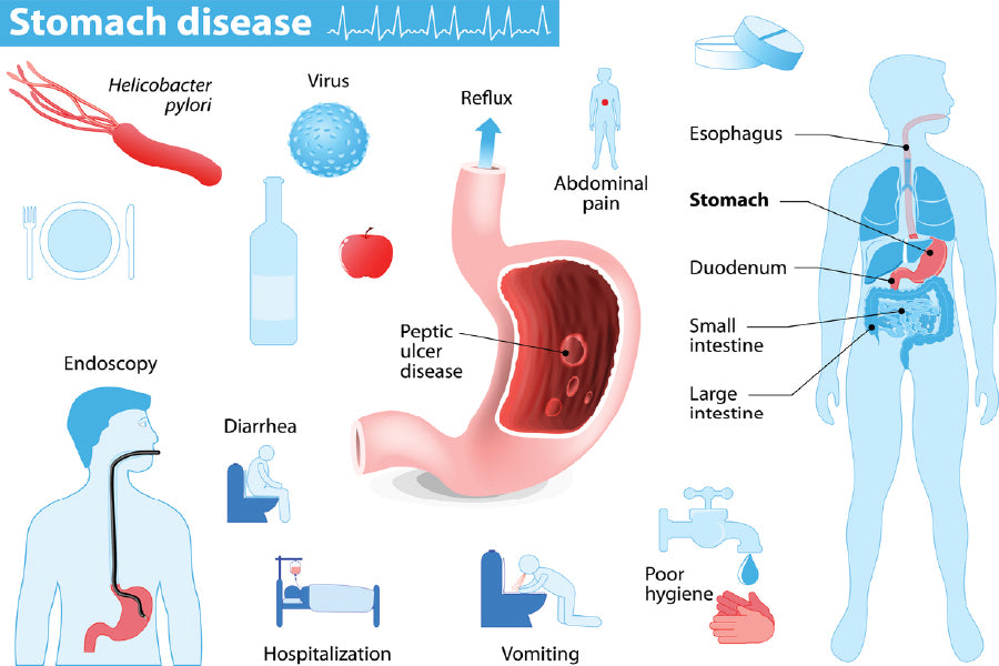 Stomach Disease Vector Illustration Print 100% Australian Made Stretched Canvas Ready to Hang - 2392